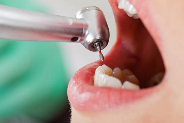 Best Emergency Dental Surgery in Maysville, OK